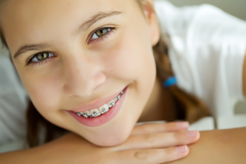 6 Tips for Managing Braces Daily