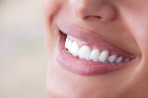 What to Know About Lingual Braces - Gibbs Orthodontics