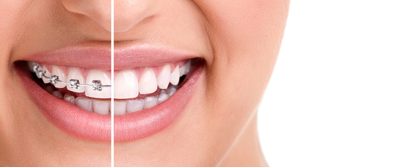 Tooth Repair, Jaw Joint Problems, Stained Teeth, Invisible Braces